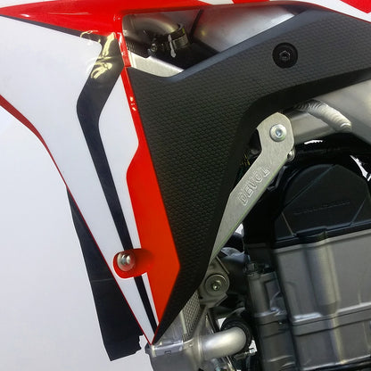 Radiator Race Braces